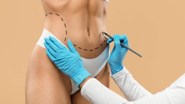 Liposuccion à Casablanca : Le Guide Complet 2026