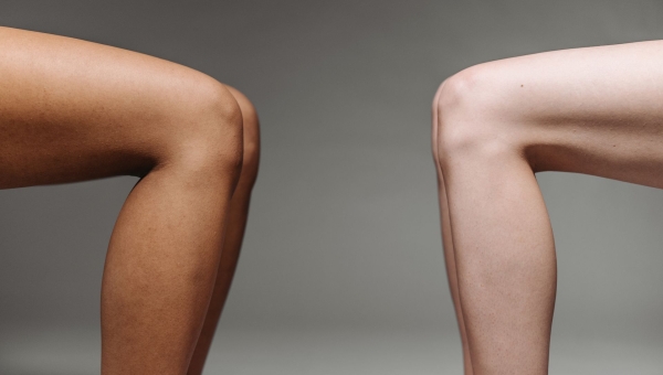 Lifting des cuisses au Maroc : prix, techniques et pourquoi c'est moins cher