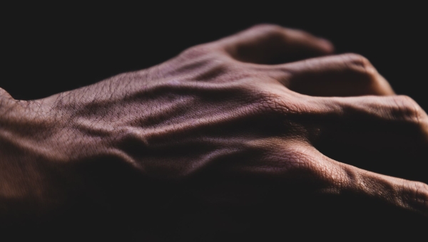 Veines Gonflées sur les Mains : Causes, Risques et Solutions