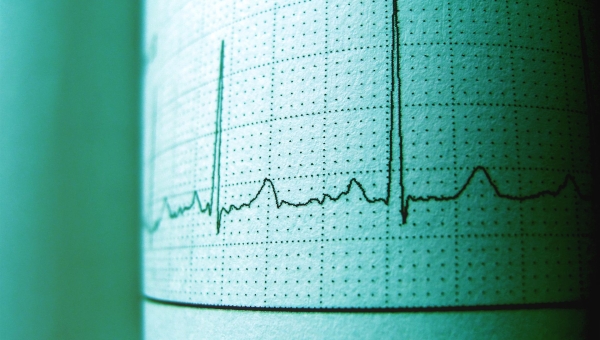 Hypertension artérielle en Afrique : causes, traitements et suivi