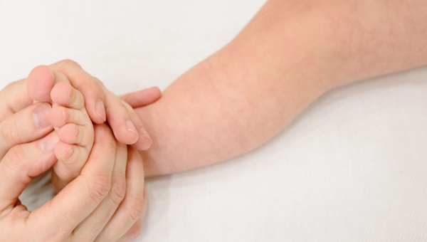 Rougeole en France et au Maroc : symptômes, vaccination et prévention 2026